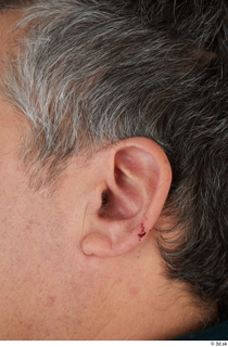 Photos of Lucas Mina ear 0001.jpg